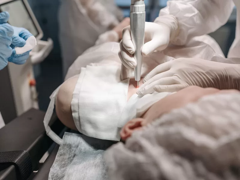 Médico realizando procedimento a laser em ambiente clínico