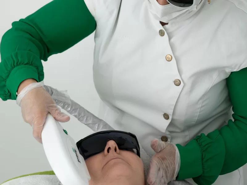 Aplicação de laser fracionado para resurfacing da pele