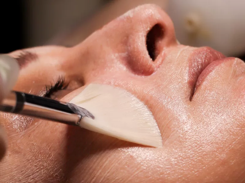 Aplicação de produto para peeling facial com pincel