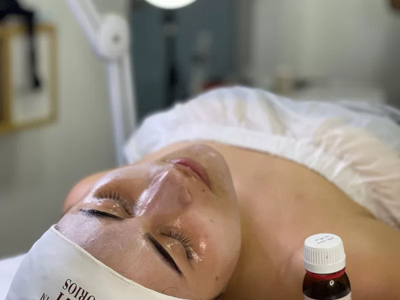 Paciente durante sessão de peeling facial em ambiente clínico