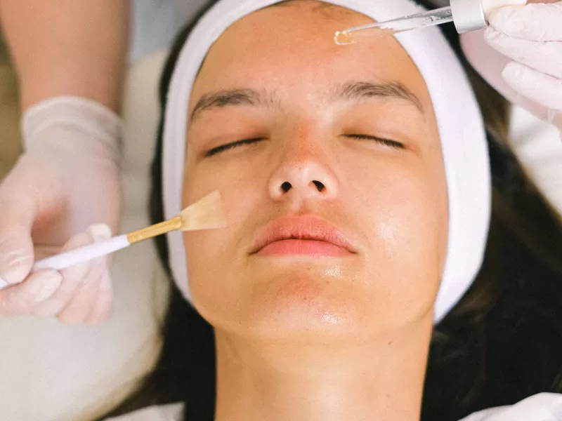 Profissional aplicando solução de peeling no rosto da paciente