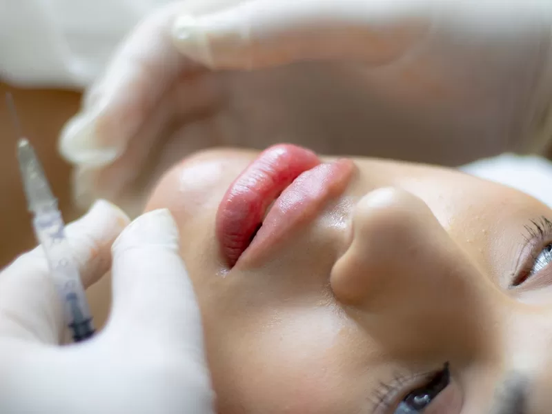 Profissional aplicando preenchedor facial com seringa